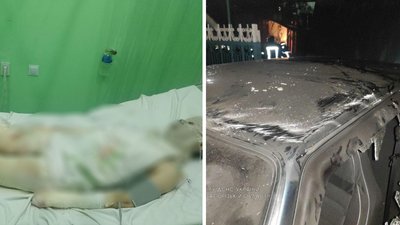 На Запоріжжі чоловік напідпитку підпалив автівку, внаслідок чого він та дружина отримали опіки