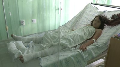 У Запоріжжі 11-річна дівчинка, яка отримала 35% опіків тіла, потребує переливання крові