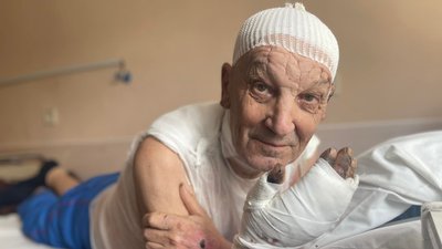 Вибрався із палаючого дому. У Львові лікують 75-річного чоловіка із Попасної