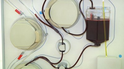 У Житомирі бракує запасів донорської крові У Житомирі бракує запасів донорської крові