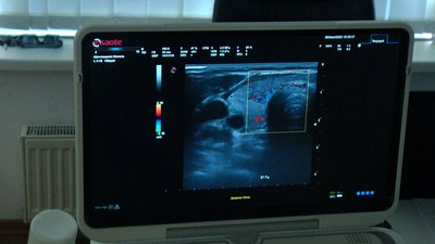 За три місяці майже чотири тисячі переселенців: як у Вінниці працюють медики Рубіжанської центральної міської лікарні За три місяці майже чотири тисячі переселенців: як у Вінниці працюють медики Рубіжанської центральної міської лікарні
