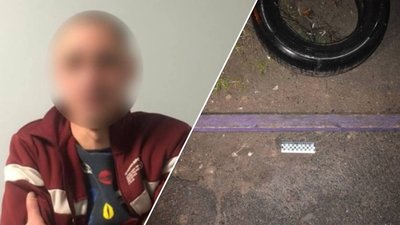 Вінничанину загрожує 8 років в'язниці за побиття знайомого деревʼяною палицею