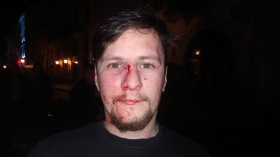 У побитті ветеранів АТО у Львові підозрюють чернівецького патрульного