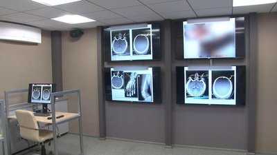 Став відомий стан двох поранених бійців, доправлених до Дніпра з Донбасу