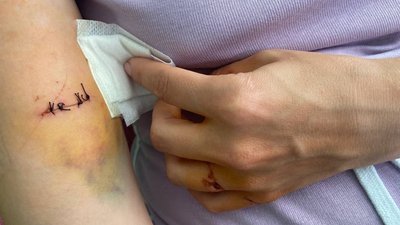 "Пам’ятаю тільки на дотик": у Диканьці на Полтавщині невідомий травмував жінку "Пам’ятаю тільки на дотик": у Диканьці на Полтавщині невідомий травмував жінку