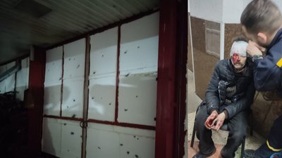 Під час обстрілу поранення отримали троє мирних жителів міста Під час обстрілу поранення отримали троє мирних жителів міста