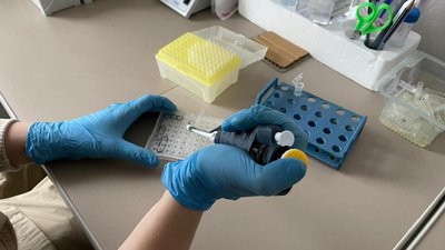 "Брат шукає зниклого безвісти брата". Як судові експерти ідентифікують вбитих на Харківщині "Брат шукає зниклого безвісти брата". Як судові експерти ідентифікують вбитих на Харківщині