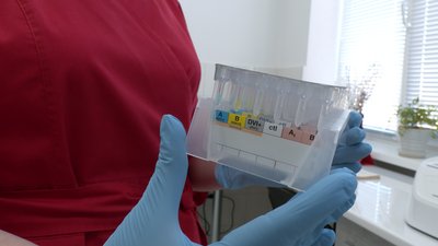 Кращі умови та нові послуги. У Чернівцях відремонтували приміщення центру крові та отримали нове обладнання Кращі умови та нові послуги. У Чернівцях відремонтували приміщення центру крові та отримали нове обладнання