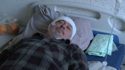 "Живіт почав пекти, я поповзла на землю": свідчення волонтерів, поранених під час обстрілу РФ у Липцях