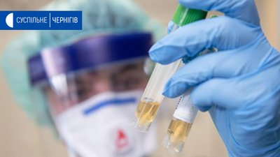 Коронавірус на Чернігівщині: 1 людина померла, 7 захворіли, 33 одужали