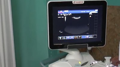 У франківському пологовому завищили ціну УЗД-апарату на півмільйона гривень, - прокуратура У франківському пологовому завищили ціну УЗД-апарату на півмільйона гривень, - прокуратура