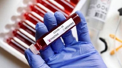 25 випадків захворювання на коронавірус виявили за добу на Полтавщині