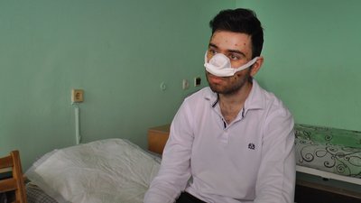 "Пів години під завалами": Як житель Крамарська вижив після влучення ракети в його будинок