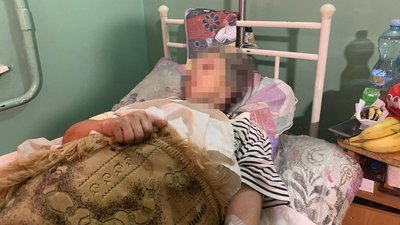 Криворізькі лікарі рятують двох жінок, які потрапили під артобстріли армії РФ Криворізькі лікарі рятують двох жінок, які потрапили під артобстріли армії РФ
