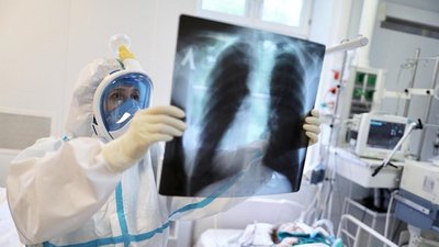 Новий рекорд: за добу коронавірус виявили у 563-х жителів області
