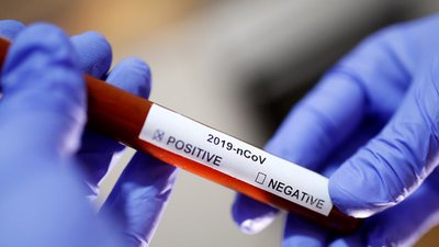 На Чернігівщині 21 людина підхопила COVID-19, ще одна хвора померла
