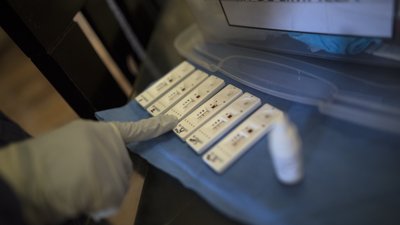 У МОЗ пояснили, чому тести на антитіла можуть бути негативними після вакцинації