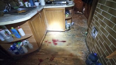 Від вибуху гранати під Житомиром травмувалися двоє чоловіків Від вибуху гранати під Житомиром травмувалися двоє чоловіків