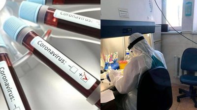 За добу захворювання на COVID-19 підтвердили у 889 мешканців Одещини