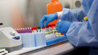 Новий рекорд: за добу на Чернігівщині 254 людини захворіли на коронавірус