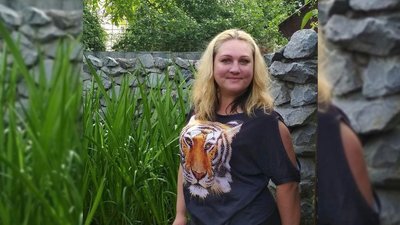 Три кілометри пішки з простреленою ногою: чернігівка при виїзді з Чернігова потрапила під обстріл Три кілометри пішки з простреленою ногою: чернігівка при виїзді з Чернігова потрапила під обстріл