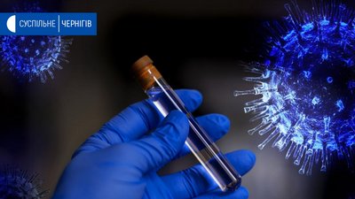 За минулу добу на Чернігівщині - 5 нових випадків коронавірусу