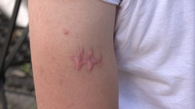 Державна програма для військовослужбовців "Медевак" Державна програма для військовослужбовців "Медевак"