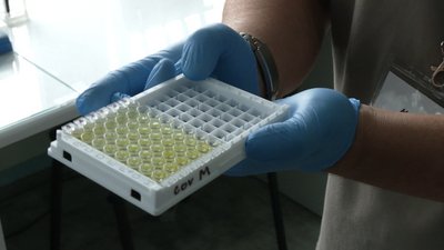 В Хмельницькій ОДА пояснили, чому не можуть закупити тест-системи для ІФА дослідження COVID-19