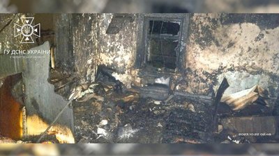 На Чернігівщині під час пожежі житлового будинку травмувалася дитина