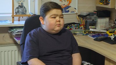 Богдан Шевчук має рідкісне генетичне захворювання
