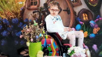 8-річна Соломія, яка має орфанне захворювання, Хмельницький