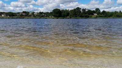 У Кіровоградській області перевірили воду в місцях для купання. Чи знайшли там небезпечні бактерії У Кіровоградській області перевірили воду в місцях для купання. Чи знайшли там небезпечні бактерії