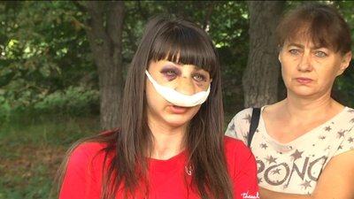 Проти чоловіка, що побив колишню співмешканку у Запоріжжі, порушили кримінальну справу Проти чоловіка, що побив колишню співмешканку у Запоріжжі, порушили кримінальну справу