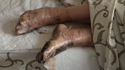 "Три пацієнти померли у реанімації": що відомо про постраждалих внаслідок ракетного обстрілу Вінниці "Три пацієнти померли у реанімації": що відомо про постраждалих внаслідок ракетного обстрілу Вінниці
