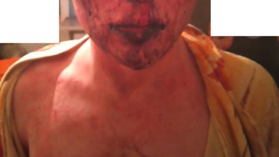 "Нам дуже страшно". Розмова з побитим трансгендером і його матір'ю "Нам дуже страшно". Розмова з побитим трансгендером і його матір'ю