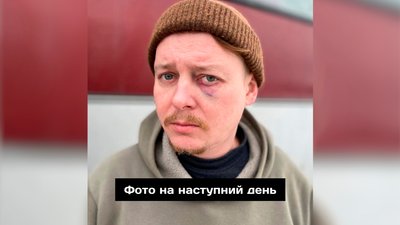 Побиття актора Чернігівського драмтеатру: що кажуть у поліції та як це прокоментував директор театру у Дніпрі Побиття актора Чернігівського драмтеатру: що кажуть у поліції та як це прокоментував директор театру у Дніпрі