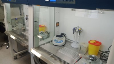 Житомирщина отримала мобільну лабораторію від США та ВООЗ, яка робитиме тести на коронавірус