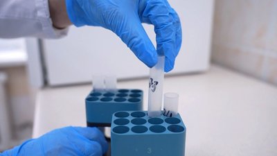 У громадах на Вінниччині реалізовують проєкт ранньої діагностики раку у жінок У громадах на Вінниччині реалізовують проєкт ранньої діагностики раку у жінок