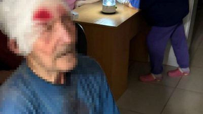 Поранений чоловік у Слатиному