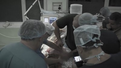 У Львові медики ампутували пальці дворічній дитині, яка запхала руку в м'ясорубку
