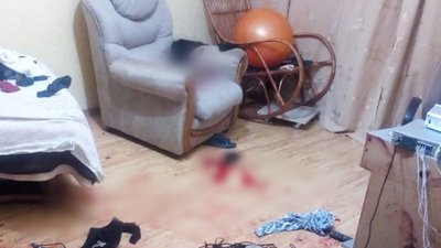 На Сумщині напали на одного з кандидатів у депутати, нападника затримали На Сумщині напали на одного з кандидатів у депутати, нападника затримали