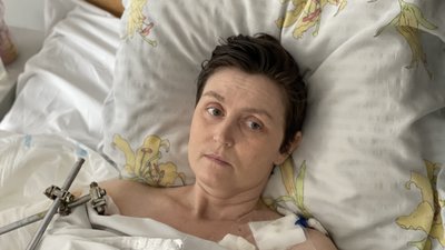 "У мене забрали все". Історія жительки Попасної, яка травмувалася через падіння снаряду "У мене забрали все". Історія жительки Попасної, яка травмувалася через падіння снаряду
