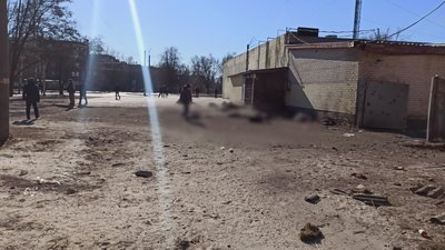 Третій місяць загоюють рани: історії людей, які вижили під час обстрілу у черзі за хлібом у Чернігові Третій місяць загоюють рани: історії людей, які вижили під час обстрілу у черзі за хлібом у Чернігові