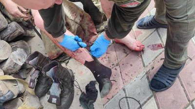 "Побратим просив, щоб я його добив, бо йому ногу відірвало": історія хмельницького добровольця Михайла Нечеснюка "Побратим просив, щоб я його добив, бо йому ногу відірвало": історія хмельницького добровольця Михайла Нечеснюка