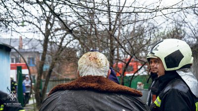На Полтавщині під час пожежі людина отримала опіки На Полтавщині під час пожежі людина отримала опіки