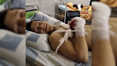 У 2021 році Леонід Бутусін отримав вибухову травму, йому відірвало палець. У 2021 році Леонід Бутусін отримав вибухову травму, йому відірвало палець.