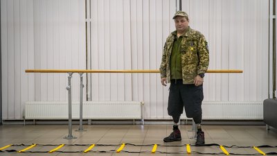 "Люди повертаються до повноцінного життя": як у Дніпрі протезують військових та цивільних "Люди повертаються до повноцінного життя": як у Дніпрі протезують військових та цивільних