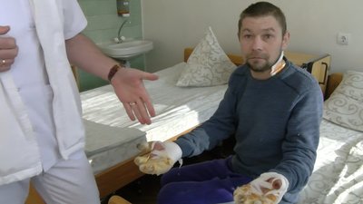 "Йшов руками по снігу": лікарі рятують пальці волинянину