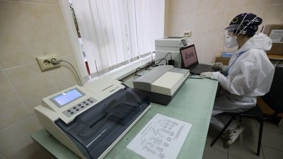"Якщо ми визначаємо імуноглобуліни G, то людина умовно вже захищена від СOVID-19"