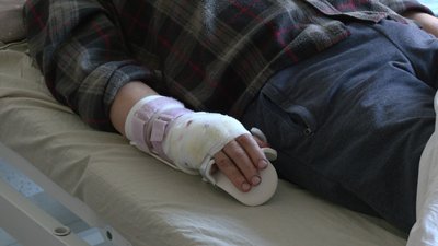 "Живіт почав пекти, я поповзла на землю": свідчення волонтерів, поранених під час обстрілу РФ у Липцях